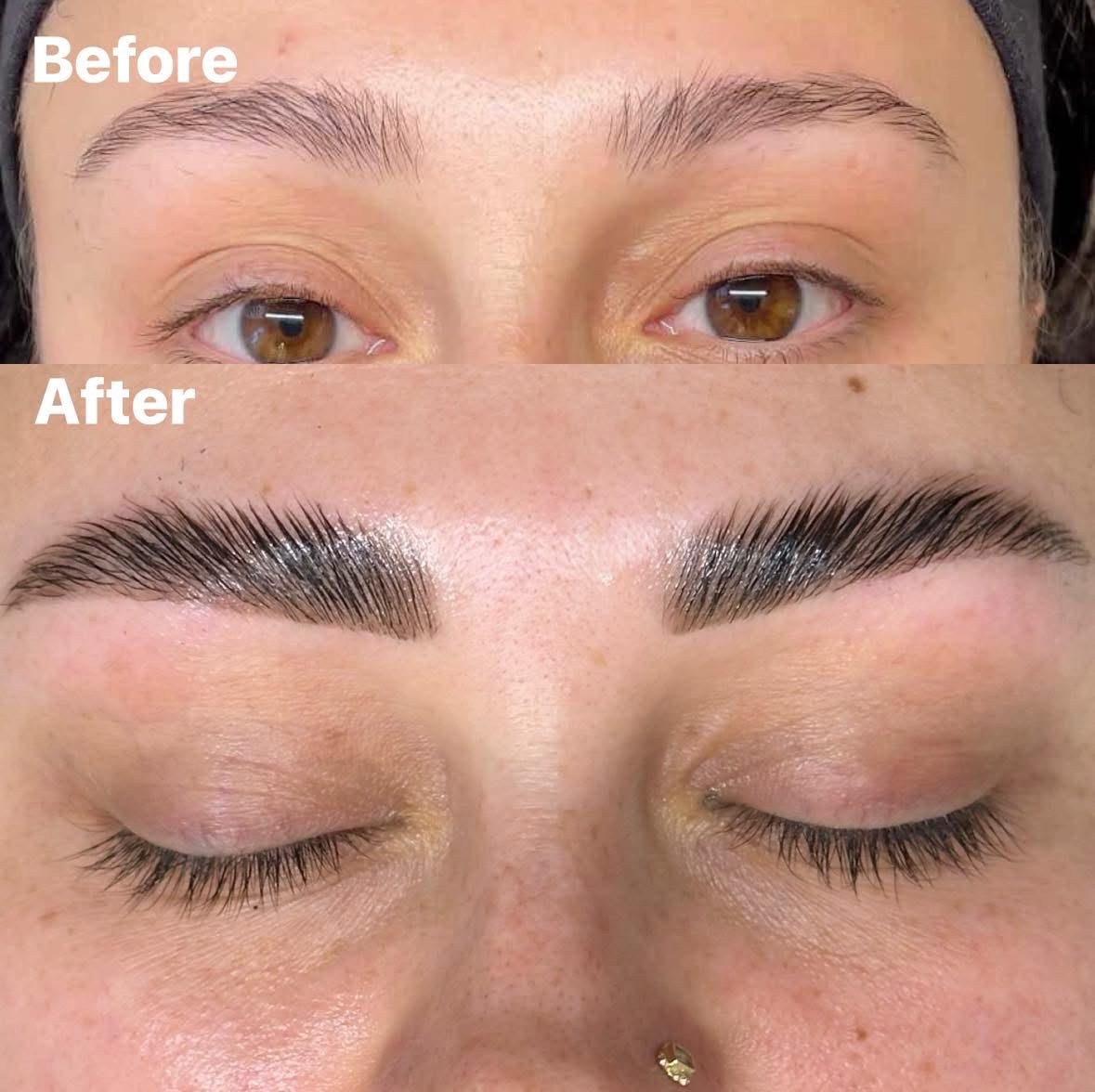 Brow transformation